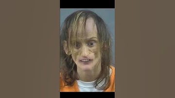 Thumbnail of The WORST Case of Drug Addiction in the World!😳 #shorts