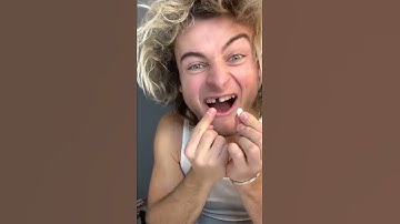 Thumbnail of TOPPER GUILD LOSES TOOTH PRANK - #Shorts